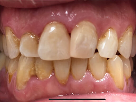 Bergen Premiere Dentistry – Before & After